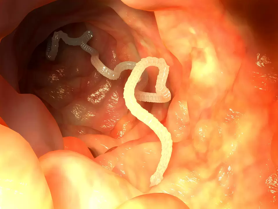 human esophagus parasite worm