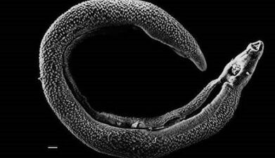 What parasites can live in a person’s liver