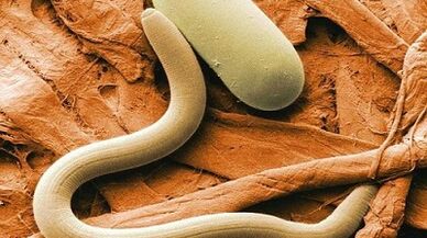 Parasites in the human body