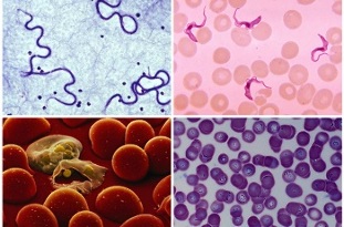 what parasites can be in human blood