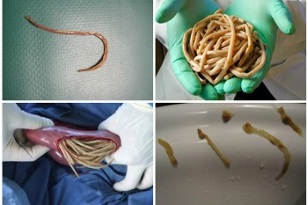 what parasites can live in the human intestine
